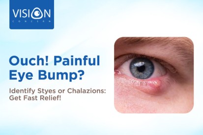 Ouch! Painful Eye Bump? Identify Styes or Chalazions: Get Fast Relief!