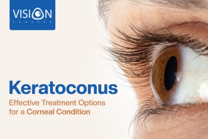 Keratoconus: Effective Treatment Options for a Corneal Condition
