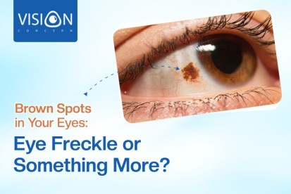 Brown Spots in Your Eyes: Eye Freckles or Something More?