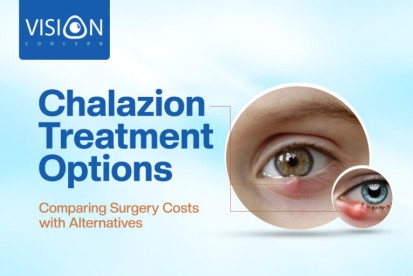 Chalazion Treatment Options: Comparing Surgery Costs with Alternatives