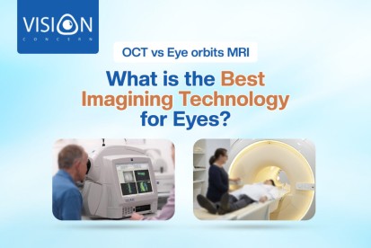 OCT vs Eye Orbits MRI: What is the Best Imagining Technology for Eyes?