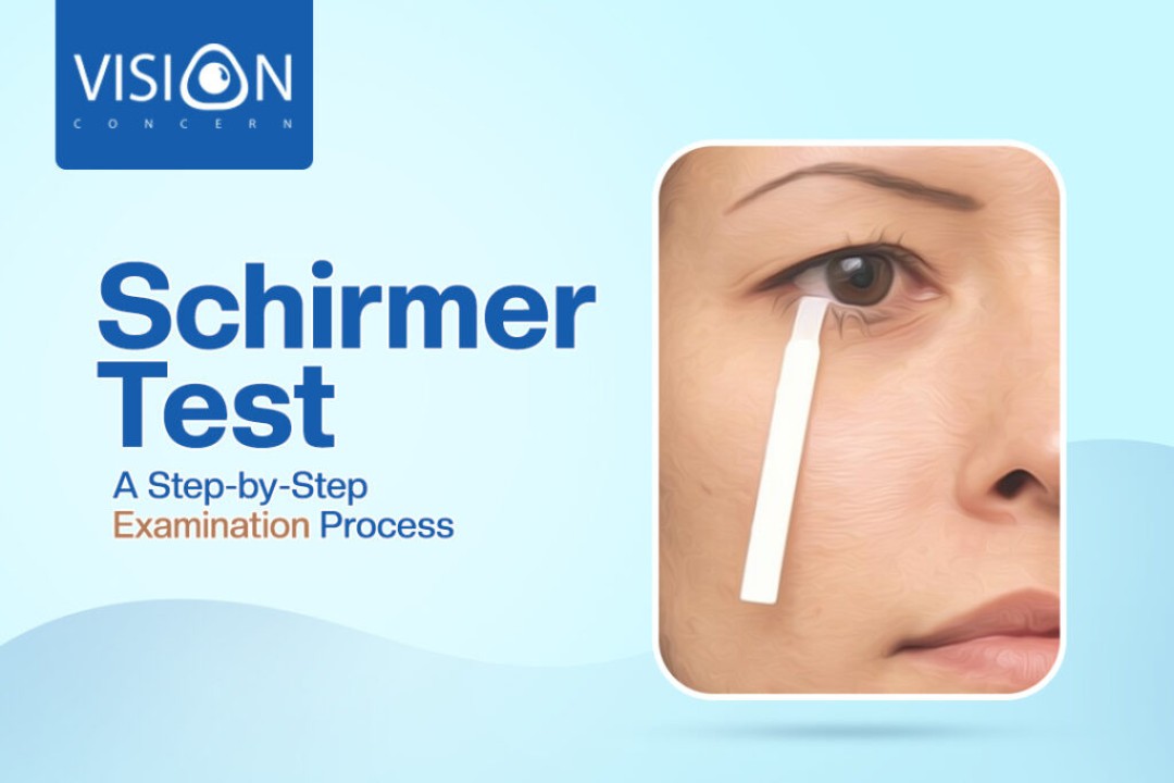 Schirmer Test: A Step-by-Step Examination Process