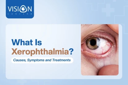 What is Xerophthalmia? Learn about its Causes, Symptoms & Treatments