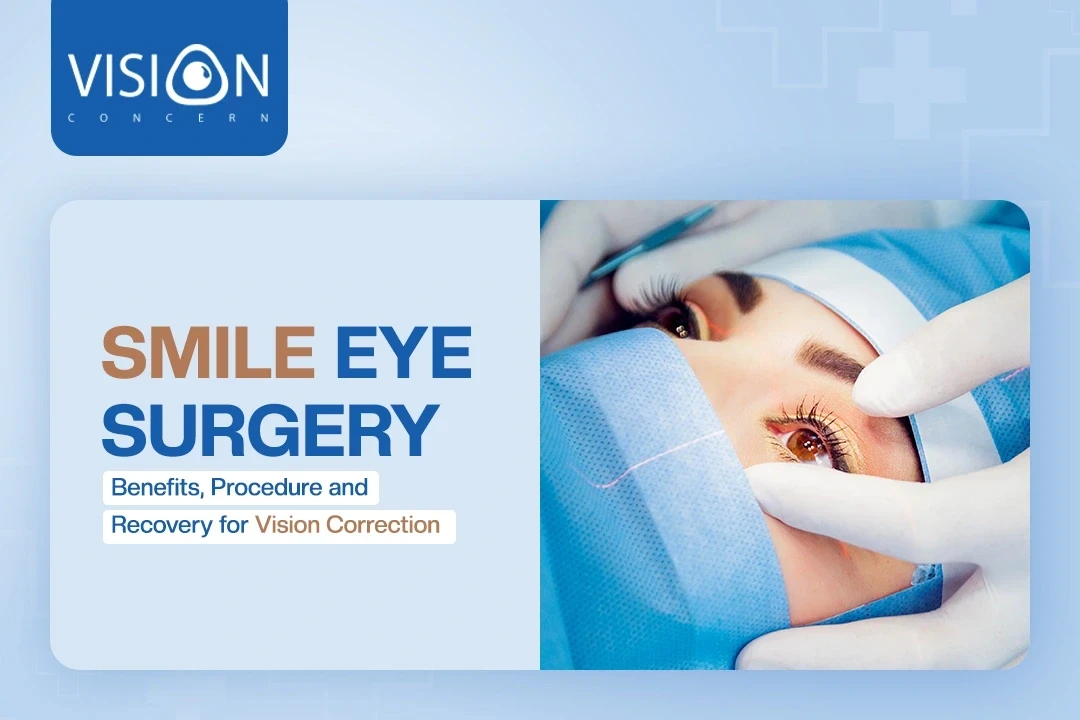 SMILE Eye Surgery: Benefits, Procedure, and Recovery for Vision Correction