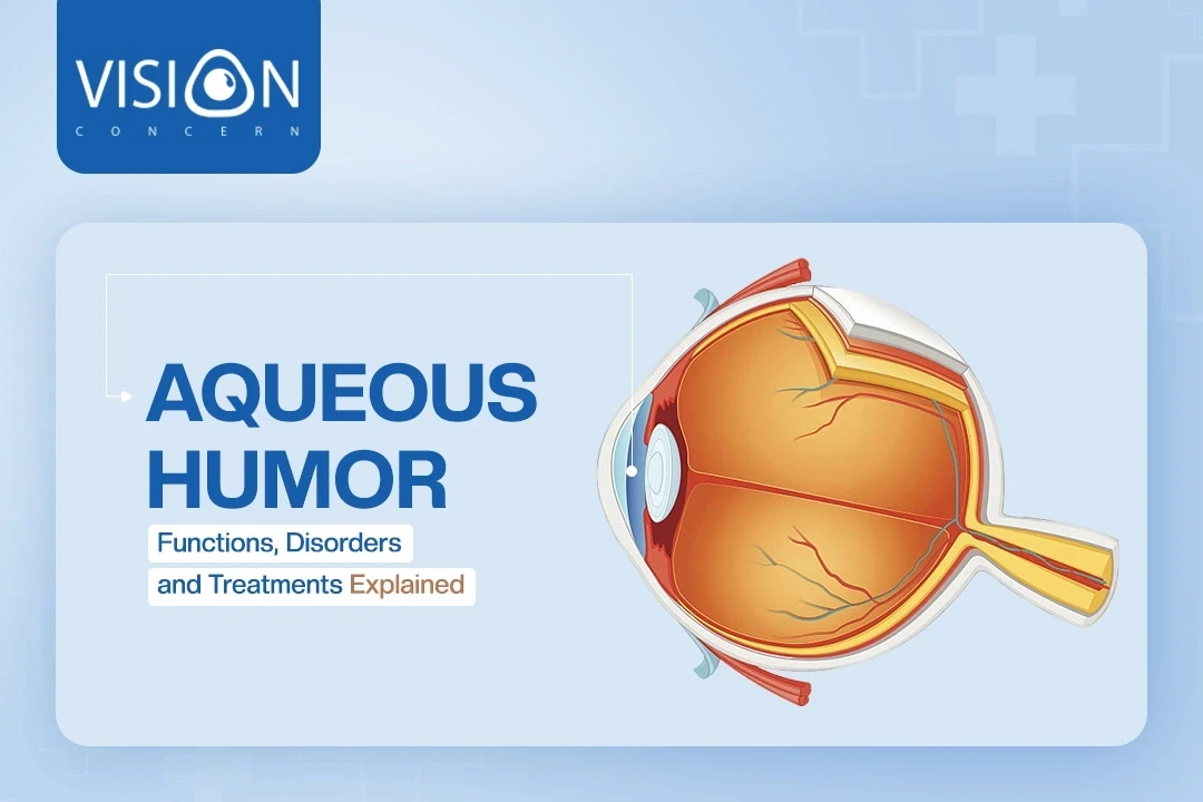 Aqueous Humour: Functions, Disorders & Treatments Explained
