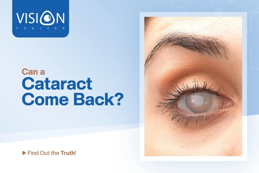 Can a Cataract Come Back? Find Out The Truth!