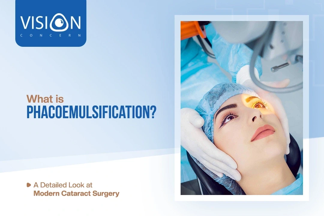 What is Phacoemulsification? A Type of Modern Cataract Surgery