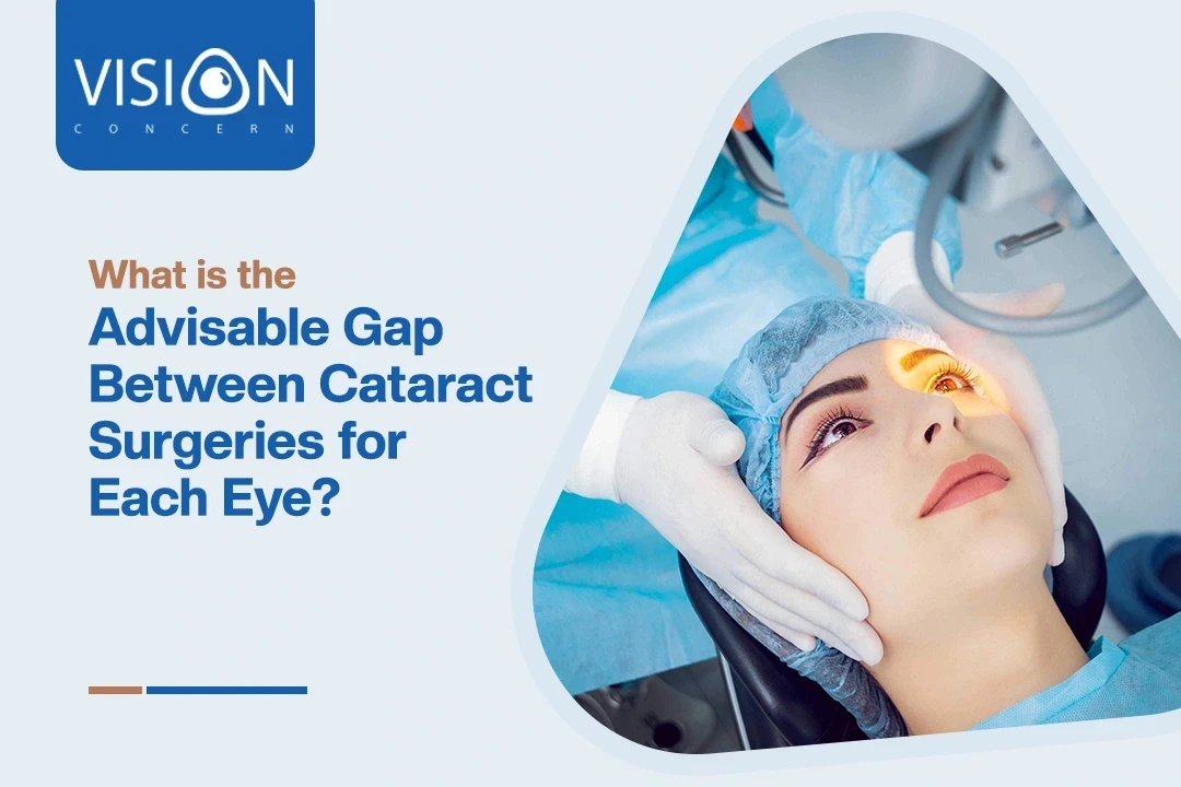 What is the Advisable Gap Between Cataract Surgeries for Two Eyes?